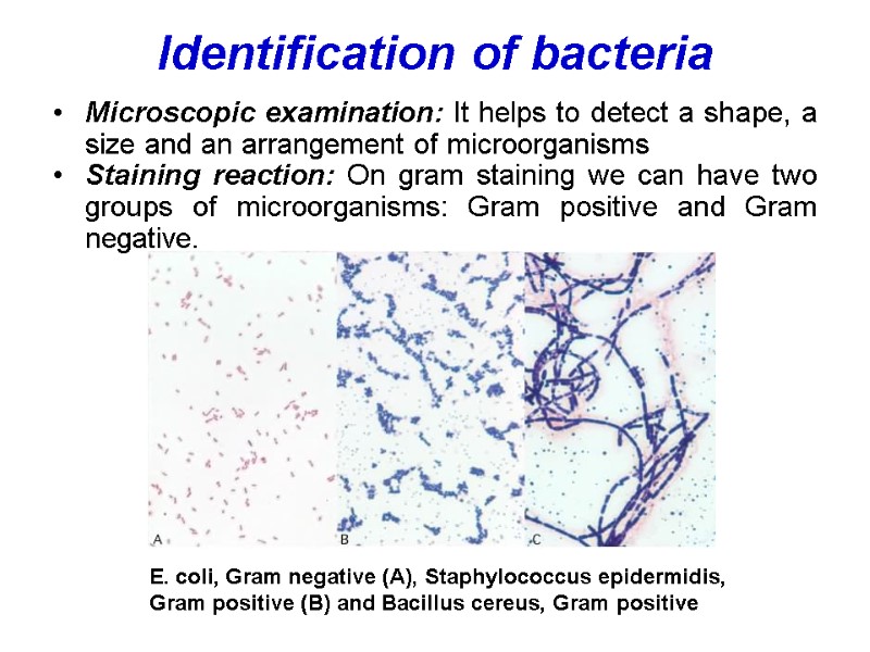 Identification of bacteria  Microscopic examination: It helps to detect a shape, a size